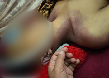Kontroversi Hukum: Remaja Luwu Tewas Diduga Dianiaya Kepala Desa Pasca-Kecelakaan, Pelaku Hanya Wajib Lapor