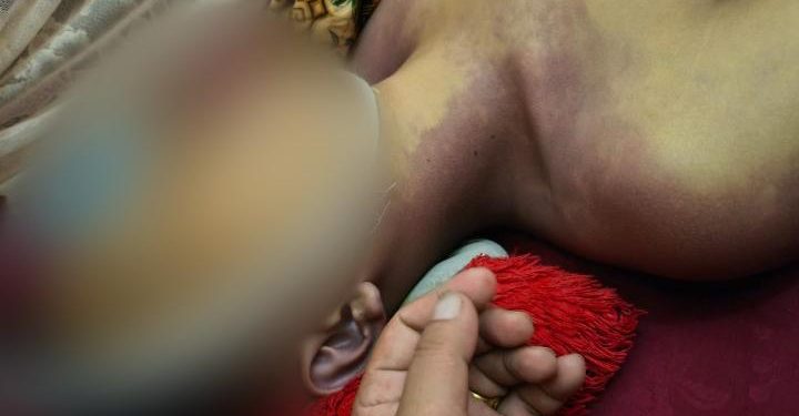 Kontroversi Hukum: Remaja Luwu Tewas Diduga Dianiaya Kepala Desa Pasca-Kecelakaan, Pelaku Hanya Wajib Lapor